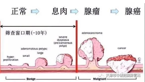 胃肠息肉到底该不该切除?