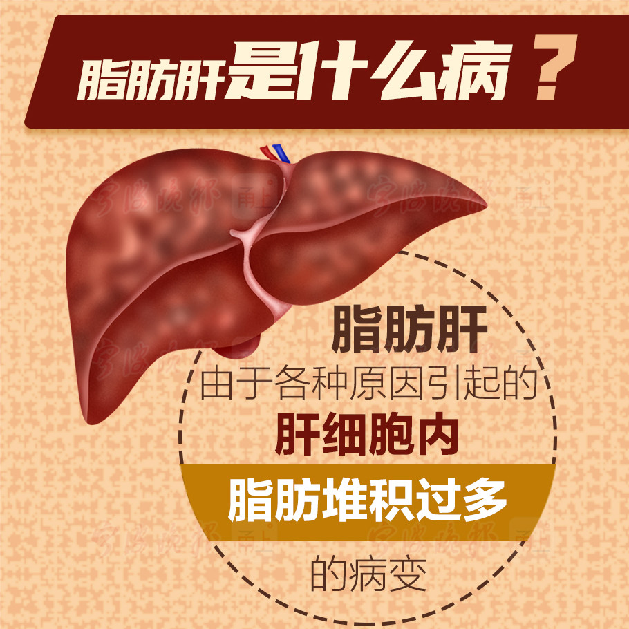 一图读懂不痛不痒的脂肪肝你可别小瞧它