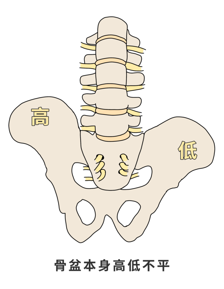 你的骨盆本身有高低不平的情况,跷二郎腿可以帮助你纠正骨盆倾斜度.