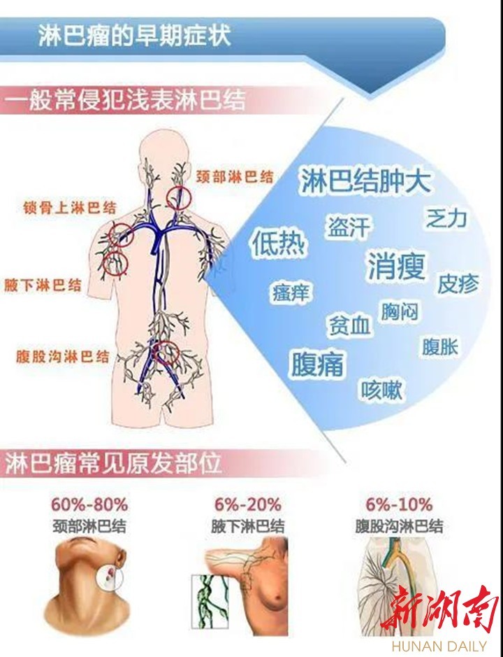 915世界淋巴瘤宣传日关于淋巴瘤您想了解的都在这里