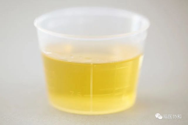 协和科普不可忽视的尿液