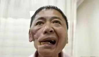 事关一亿消费者与口腔癌挂钩争议不断的槟榔监管突然出手