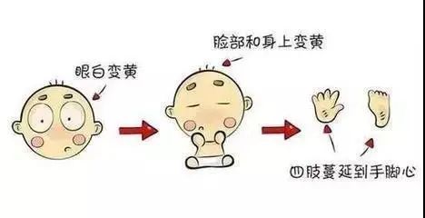 宝宝黄疸时,新手爸妈要观察什么呢?