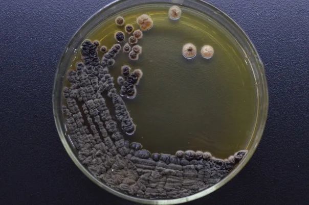 孢子丝菌引起上肢皮肤软组织慢性感染病例分析