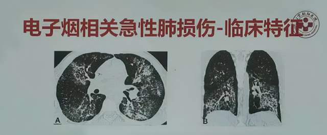 你抽的电子烟,让这个湖南老板身家640亿