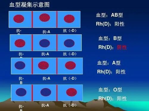 abo型将人的血型分为a,b,o,ab四个血型.