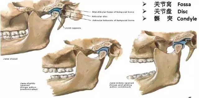 颞下颌关节的基本解剖结构如下图:髁突在关节窝里进行转动(rotation)