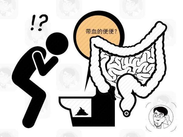 大肠癌不是悄无声息,排便时出现4个"异常",及时检查