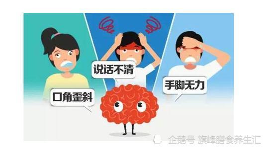 脑梗塞前的六个先兆表现,提前预防很重要