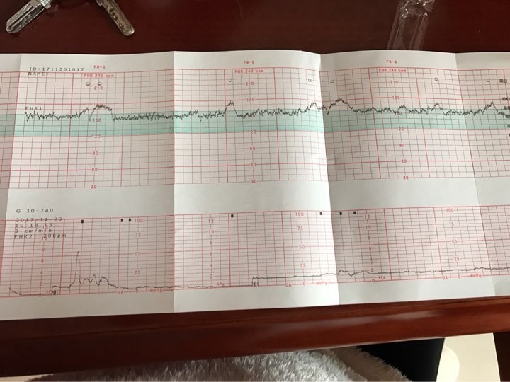 孕晚期频繁进行胎心监护检查?其中的原因孕妈要知道