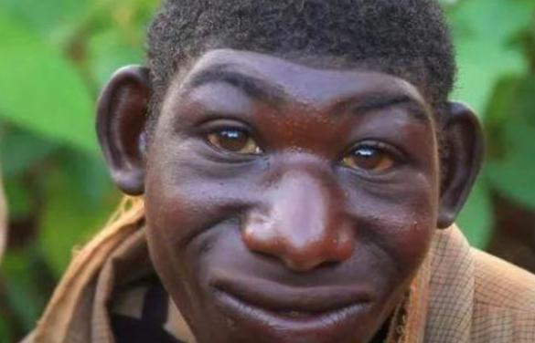 非洲一23岁男子,爱吃香蕉长得像猴子,常被他人当动物欺负