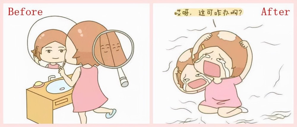 产后大量脱发的你感觉人生都黑暗了