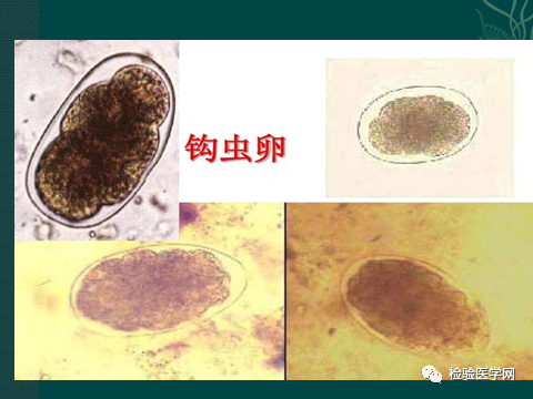 大便里的寄生虫竟然爬到了嗓子眼粪毒有这么可怕吗