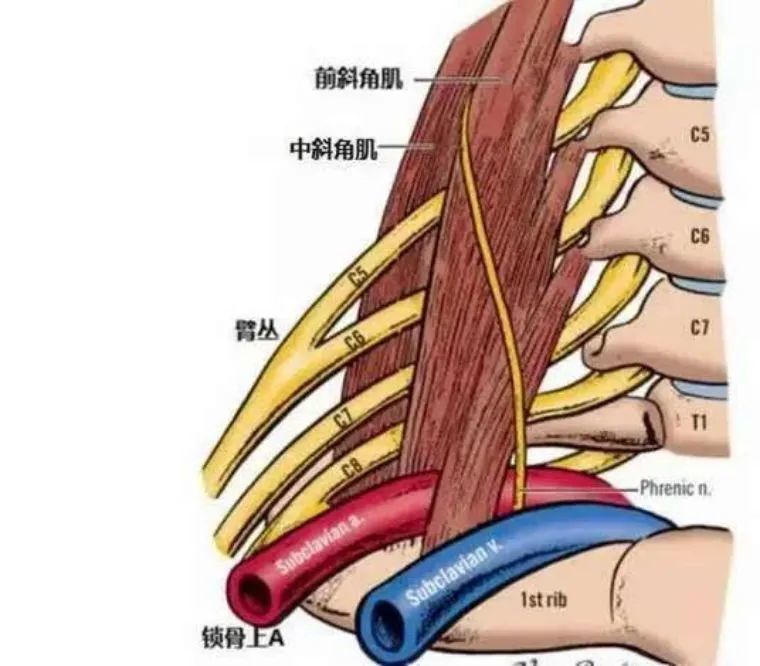 其中中斜角肌周围的腱性结构容易造成胸长神经损伤和刺激颈丛神经.