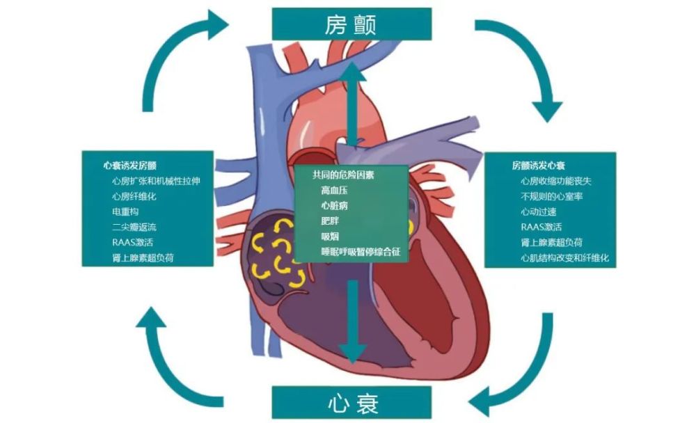 房颤遇上心衰该如何解救这对难兄难弟