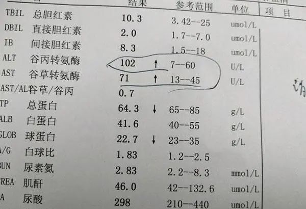 转氨酶高是什么原因造成的?可能和这6个原因有关,建议