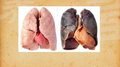 吸烟的人要经常养护自己的肺如果能完成这几个动作肺很健康