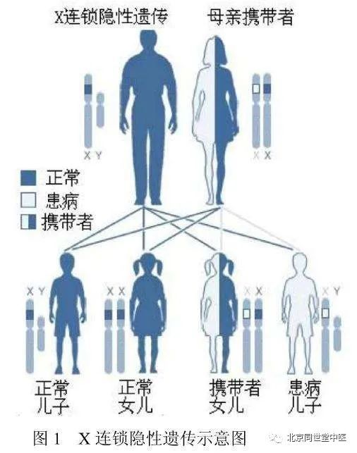 健脑止萎汤是如何治疗进行性肌营养不良的?