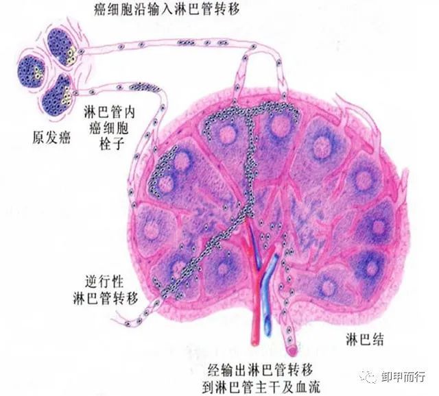 【图说13】如何识别甲状腺癌转移淋巴结?_腾讯新闻