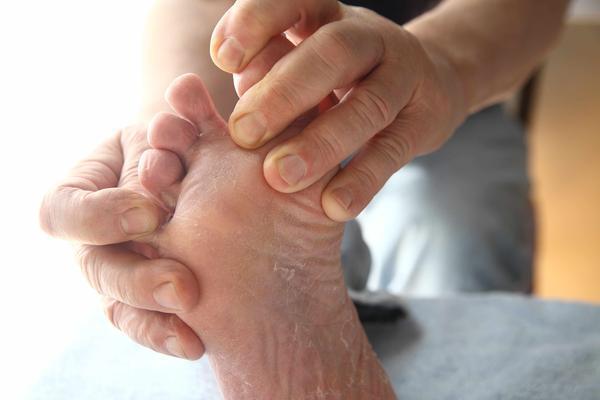 糖尿病患者,要跨过糖尿病足这个"坎",早期5个症状,留心观察