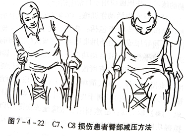 脊髓损伤患者的作业治疗