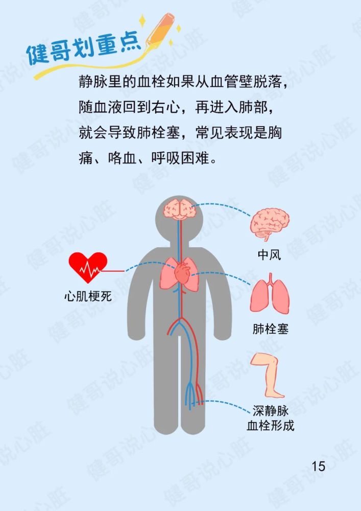 健哥说心脏漫画版|双面血栓