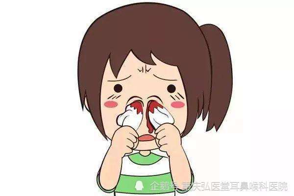 2,涂抹软膏:当鼻血被控制后,在鼻内涂一些维生素e软膏.