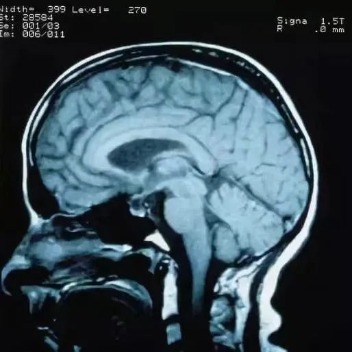 小编满脑子都是前几天去拍的牙片…想到那两颗安静"躺着"的智齿,小编