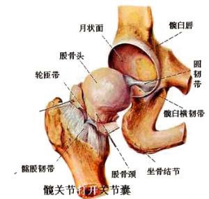 股骨头坏死还能调理好吗