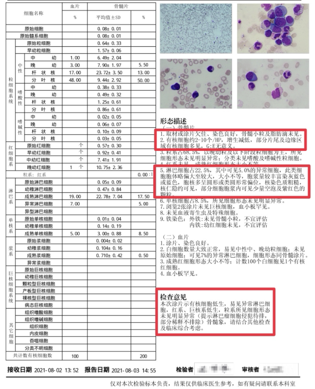 骨髓涂片:提示淋巴瘤细胞侵犯待排,部分稀释不排除各类检查报告分别如