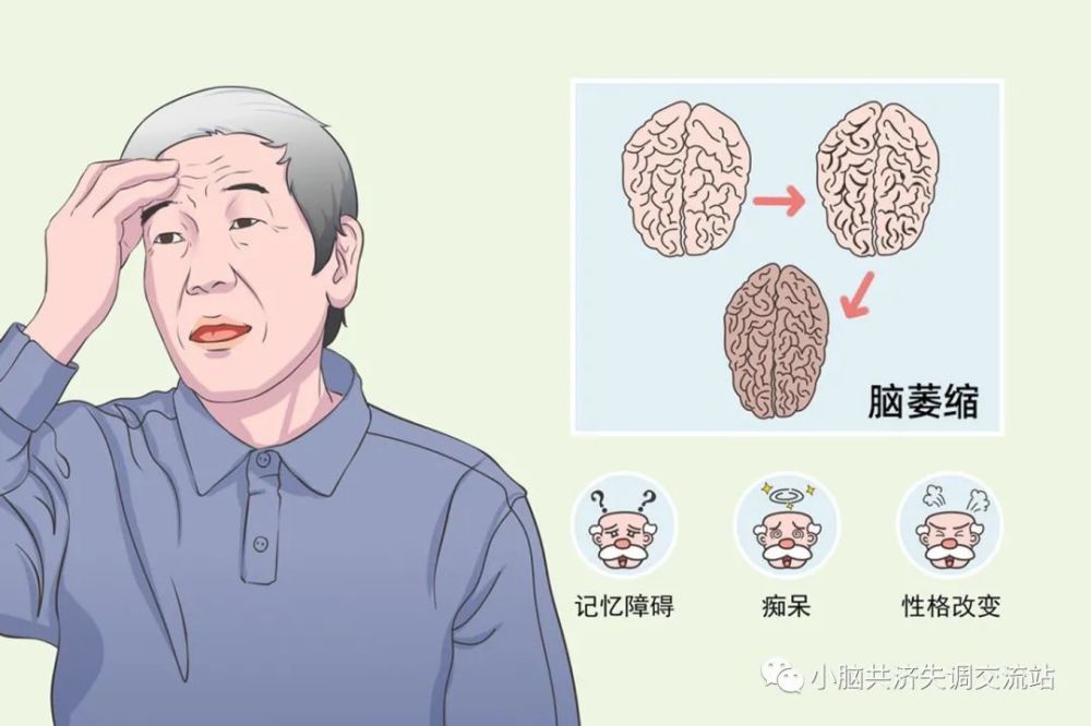 小脑萎缩共济失调会突然出现吗?