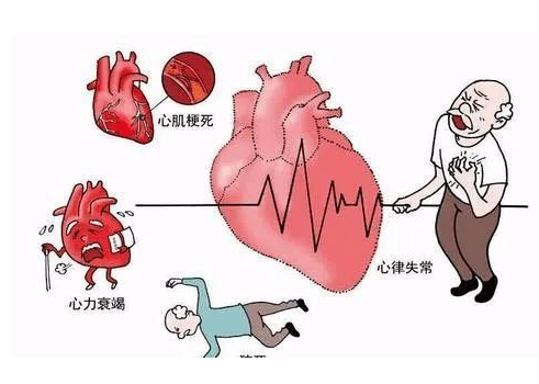 心脏病的症状以及预防