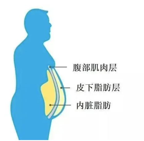 不胖却有小肚子到底是怎么回事