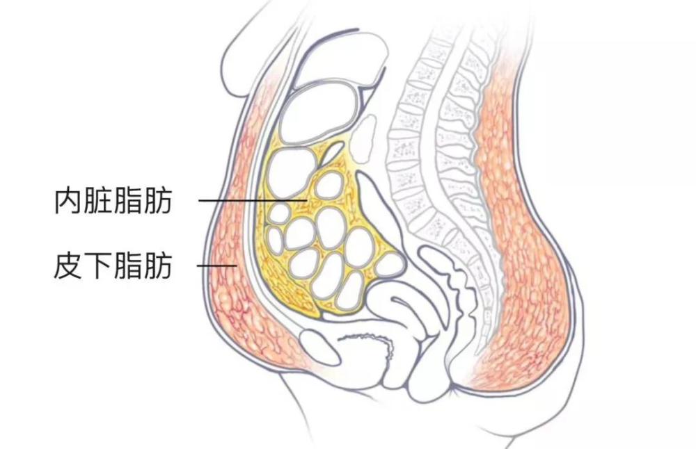 根据堆积部位不同,人体身上脂肪可分2种: 内脏脂肪 皮下脂肪