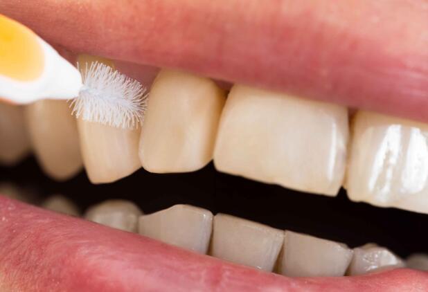牙齿出现这5个问题可能是疾病来敲门的征兆趁早检查