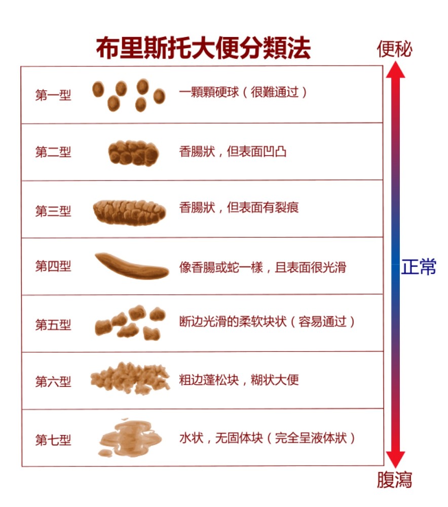 便秘憋了好久的大便,最后都去了哪里?