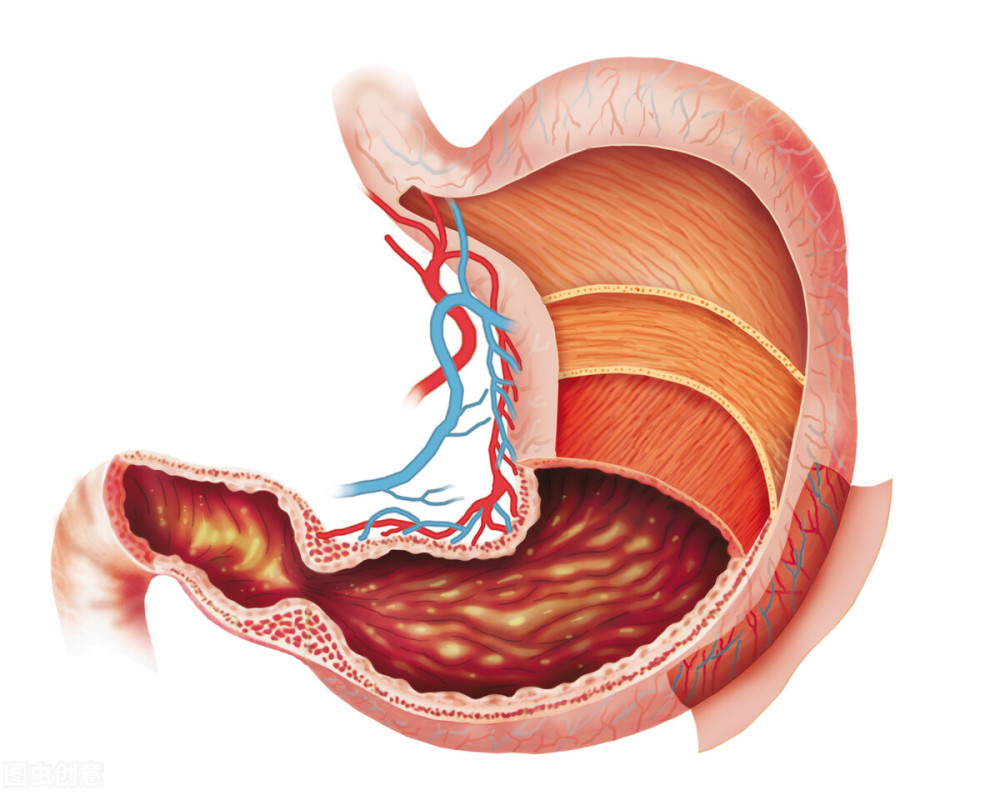 指肠淋巴管网连接,胃周淋巴结多达16组,加上胃癌的发病部位是多种多样