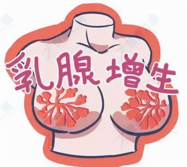 困扰女性的乳腺增生这里有详解