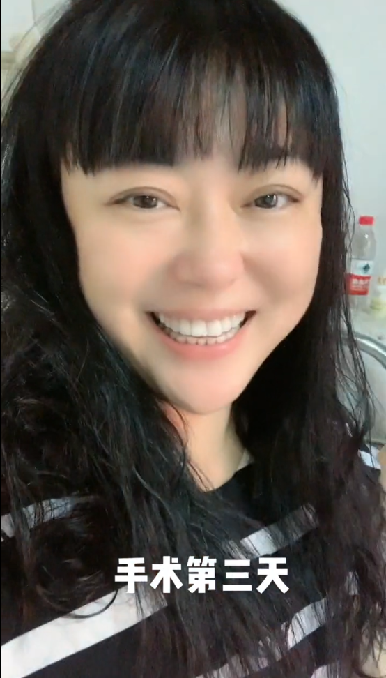 51岁李菁菁自曝患癌,晒术后照面容消瘦,深情表白孩子和90后老公