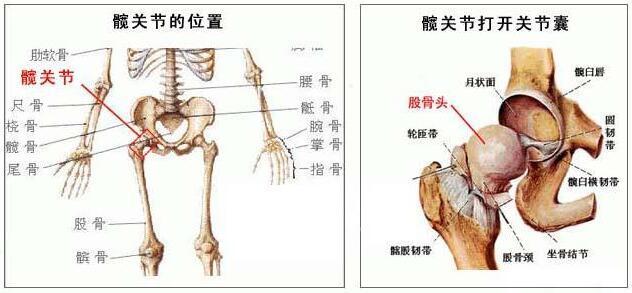 股骨头坏死治疗不及时危害很大后遗症非常严重