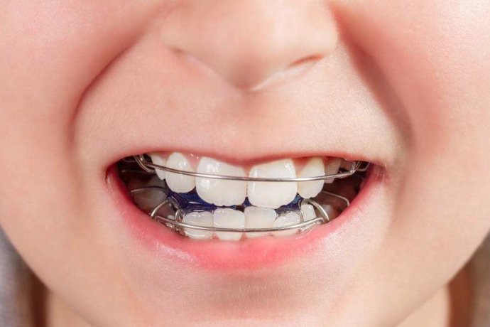 郑州儿童牙齿矫正的方法