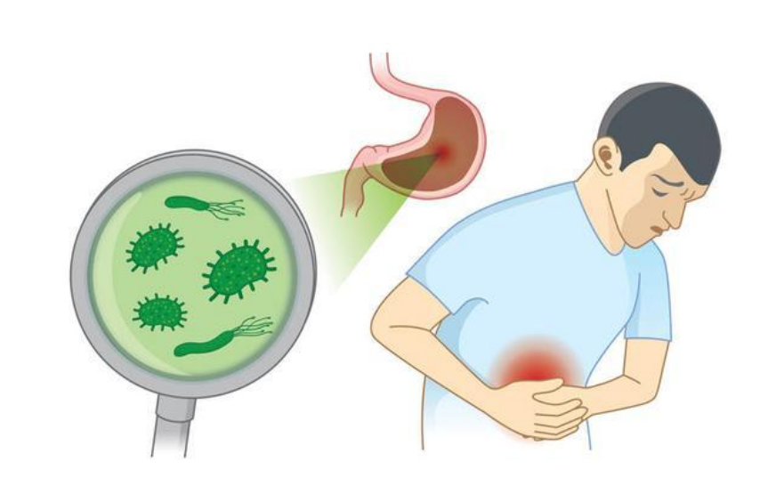 胃溃疡若不重视可能会变成胃癌出现这些症状别大意