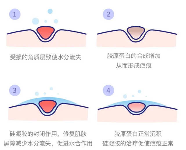 图片来源:giphy.com最后疤没去掉,皮肤反而被折腾得愈发敏感.