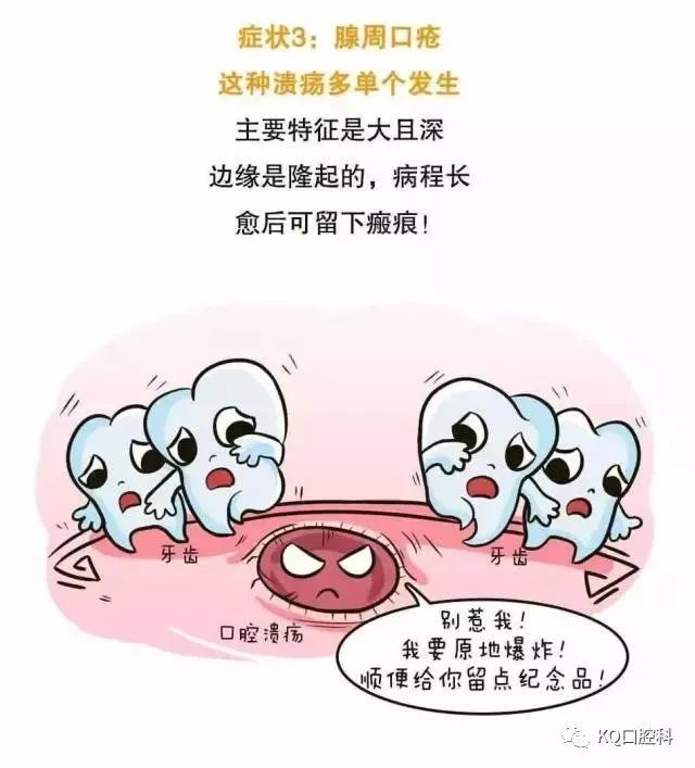 口腔溃疡,原来是一场免疫之战!
