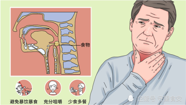 原创丨吃东西噎到严重可能丧命被噎到怎么办如何避免噎到