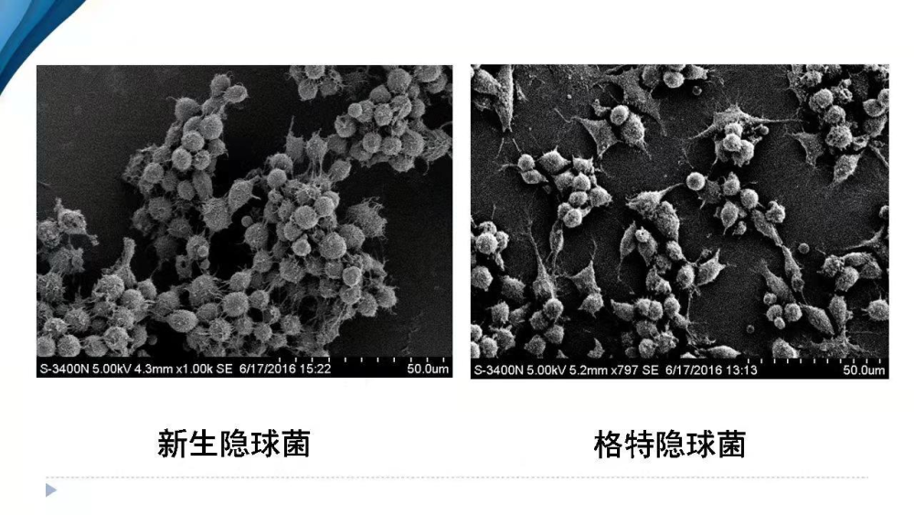 26岁女士肺部长出大片阴影她怎么了医生趣解肺隐球菌病