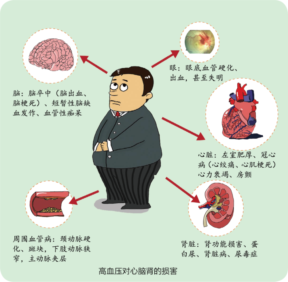 健康科普健康杀手高血压高血脂高血糖高尿酸各个身怀绝技