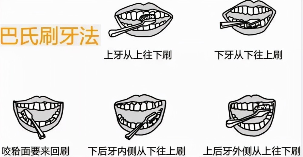 多采用巴氏刷牙法,巴氏刷牙法的刷牙方法和我们常用的水平横拉法相反