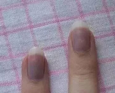 为什么脸上从不起鸡皮疙瘩,汗水是咸的,冷时指甲会变色?