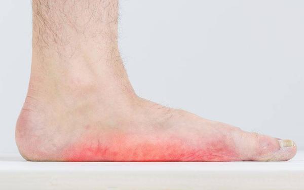 当这5种疾病发生时,脚底会出现异常的疼痛,若你有,需重视